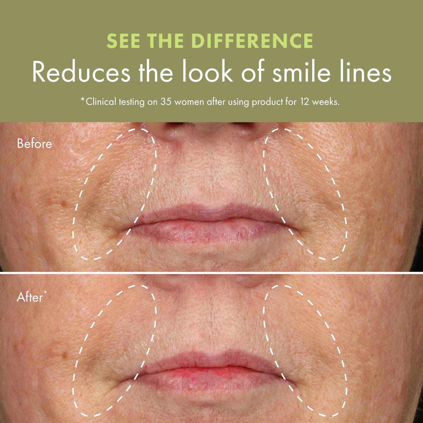 Origins Plantscription Anti-Aging Serum with Retinoid | Visibly Reduces Stubborn Wrinkles | With Retinoid & Peptide | Gentle Enough for First Time Retinoid Users | Travel Size, 1 Fl Oz