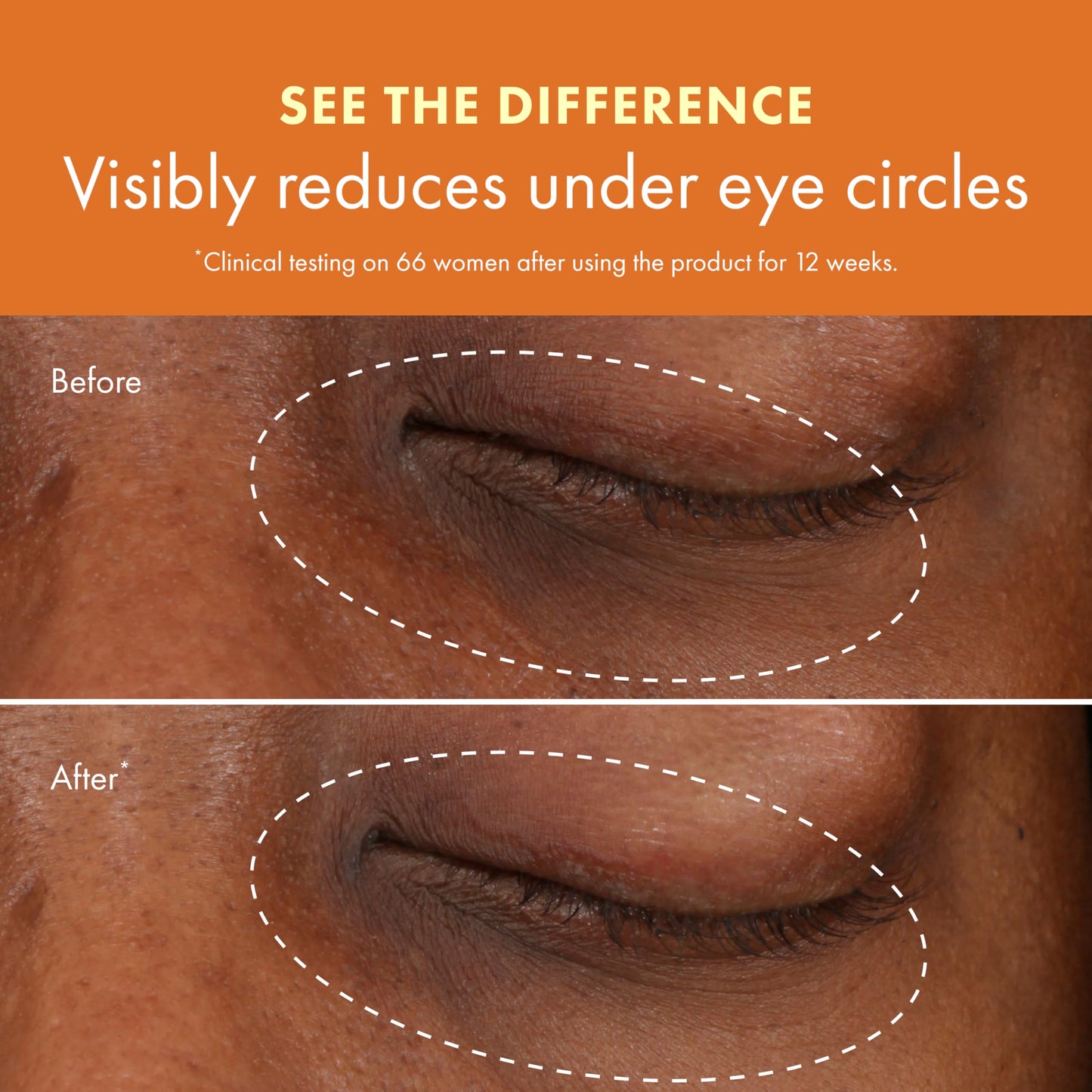 Origins GinZing Brightening Eye Cream with Vitamin C & Niacinamide| Visibly Reduces Dark Circles, Warm, 0.5 Fl Oz