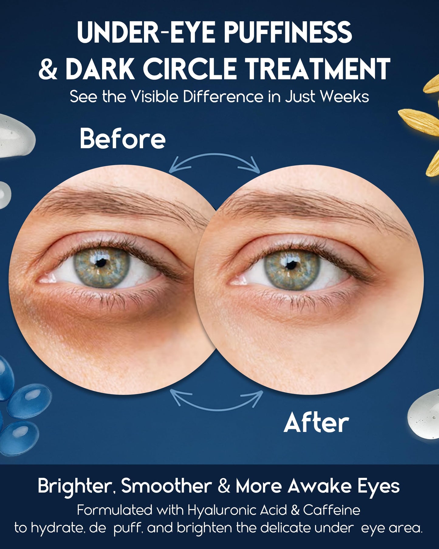 Under Eye Cream for Puffiness and Bags Under Eyes, Eye Bags Treatment for Men & Women - Anti Wrinkle Cream for Dark Circles, Baggy Eyes Treatment for Women with Retinol, Hyaluronic Acid & Caffeine