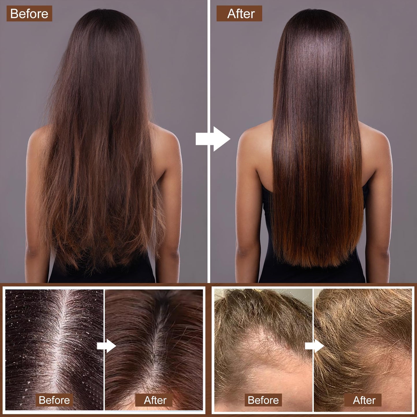 Hotiary Darkening Shampoo Bar & Rice Water Conditioner Bar Set, Rice Water Hair Growth Shampoo Soap Bar for Thinning Hair and Hair Loss, pH Balanced, for Fine & Oily Hair - Easy for Travel