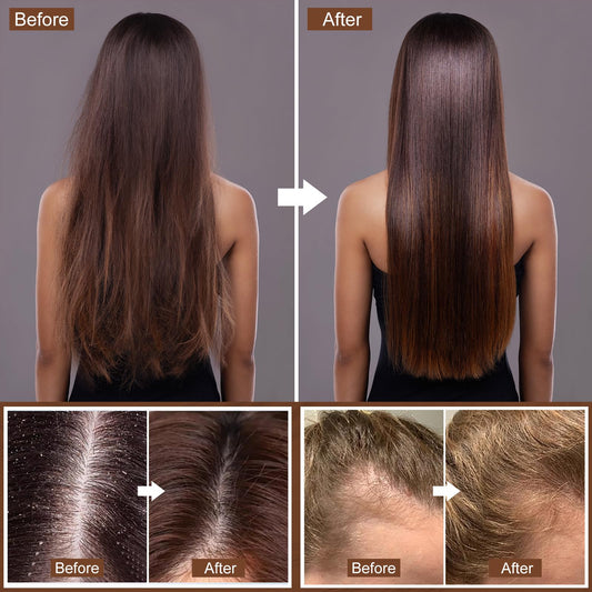 Hotiary Darkening Shampoo Bar & Rice Water Conditioner Bar Set, Rice Water Hair Growth Shampoo Soap Bar for Thinning Hair and Hair Loss, pH Balanced, for Fine & Oily Hair - Easy for Travel