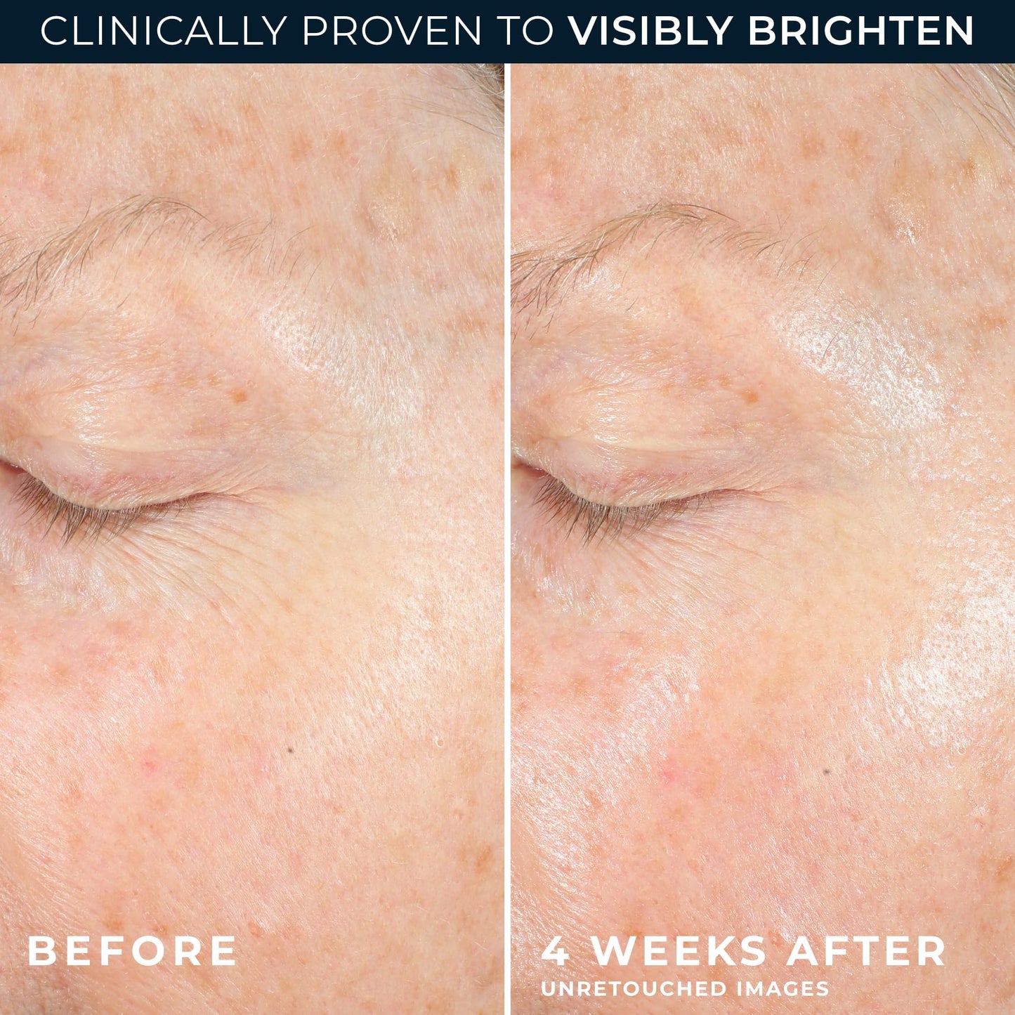 RoC Multi Correxion Revive + Glow 10% Vitamin C Moisturizer for Face, Anti-Aging Gel Cream, Instant Glow, Hypo-Allegenic, Oil-Free, 1.7 Ounces (Packaging May Vary