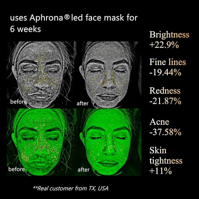 Aphrona Led Face Mask Light Therapy, Halo Led Light Therapy Facial and Neck Skin Care Mask, Blue Light Red Light for Acne Wrinkle Reduce, New Generation Face and Neck Photon Mask