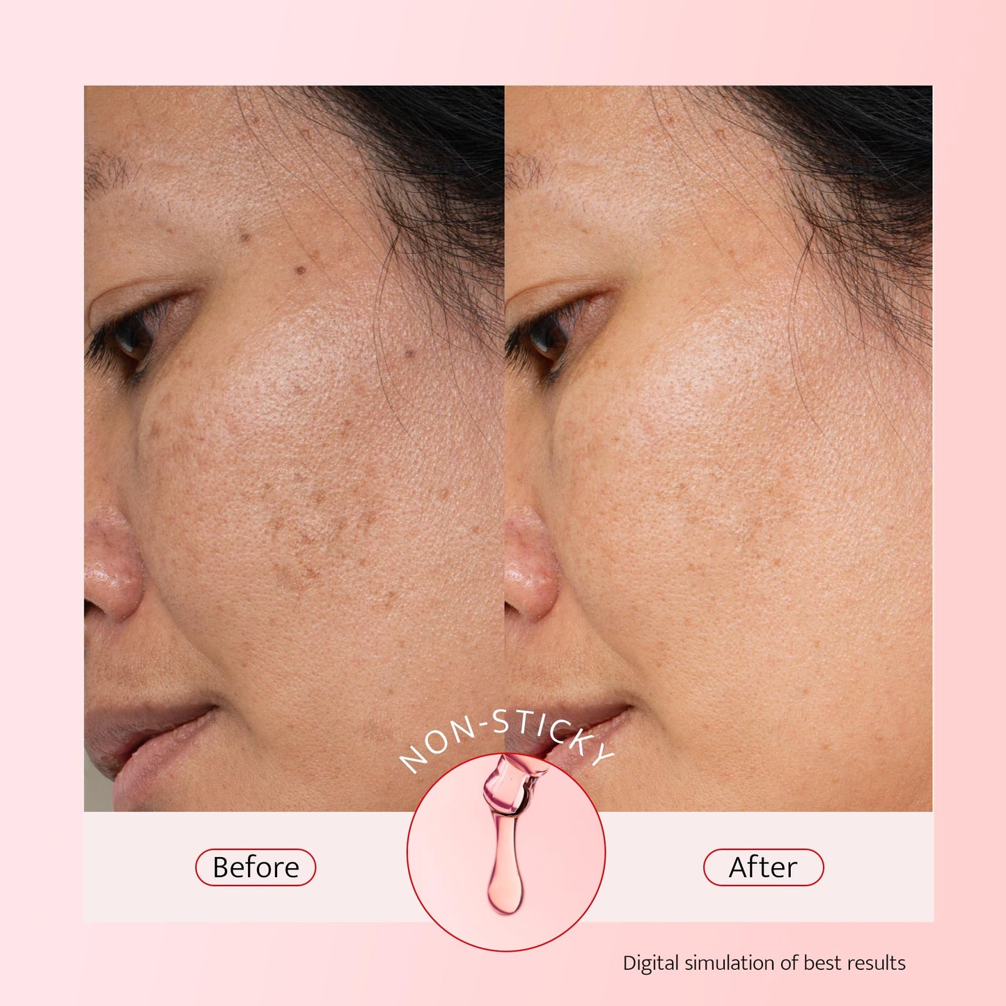 Bestkiss 10% Niacinamide + 5% Tranexamic Acid + 2% Alpha-Arbutin Dark Spot Serum with Ceramides Hyaluronic Acid Centella Asiatica - Korean Glass Skin Vegan Paraben Fragrance Cruelty Free 1 FL OZ/30mL