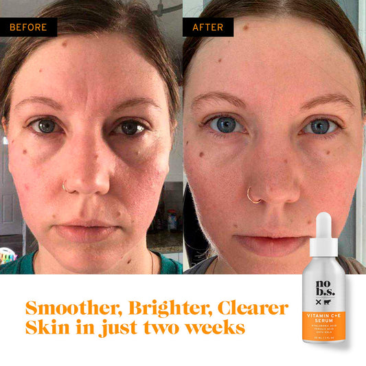 No Bad Stuff - Vitamin C + E Serum - Firming Face Serum for Anti-Aging, Smooths, Hydrates, Plumps Fine Lines & Reduces Dark Spots (1 fl oz)