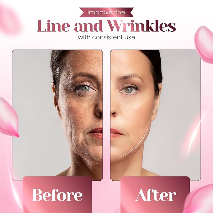 KLY Beauty Face & Neck Massager – 7-Color LED Light Therapy Device with Soothing Heat & Vibration for Relaxation and Skin Rejuvenation – White