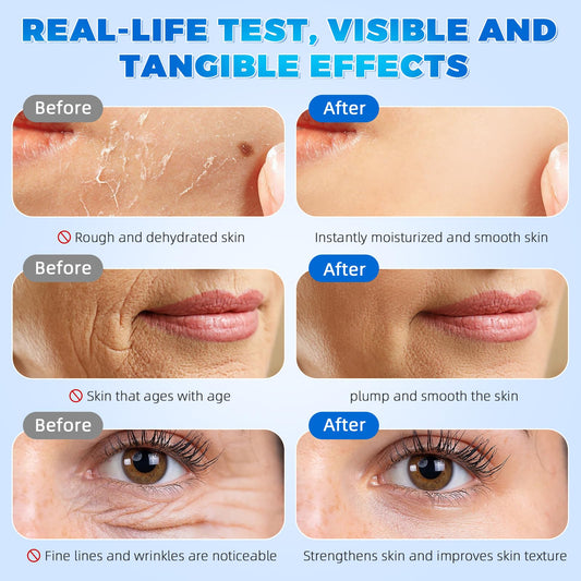 3% Hyaluronic Acid Serum Ultra-Hydrating Vials 30 pcs - 3% Hyaluronic Acid Serum For Face - Single Use Hyaluronic Acid Tubes - Intensive Moisturizing, Skin Tightening, Emergency Repair, Anti-Aging