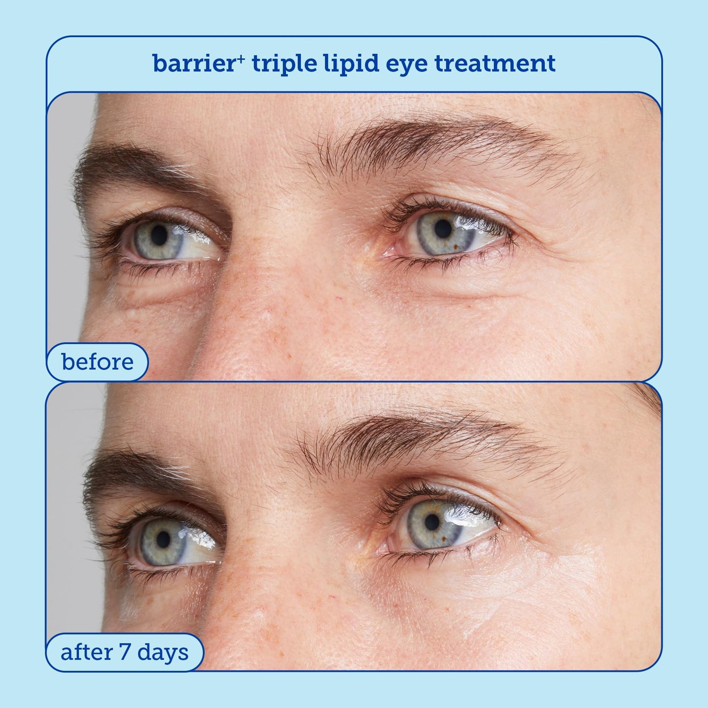 Skinfix Barrier + Firm Trio - Full-Size Plumping Serum, Mini Moisturizer, Mini Eye Cream with Patented B-L3™ Complex - Hydrate & Strengthen Skin Barrier