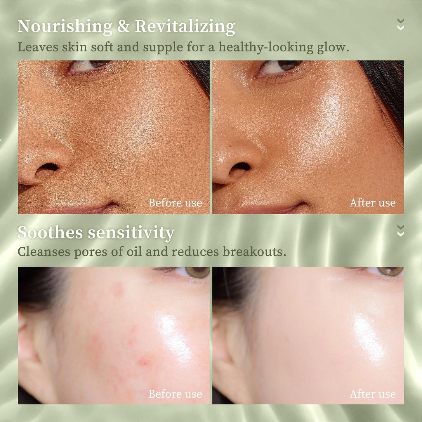 Grospe Organic Aloe Vera Gel Stick for Face & Body, Pure Aloe Gel Ideal for Hydrating, Soothing for Dry Skin, Anti-Wrinkle, Acne Scars, Soothing After Sun Care Relief