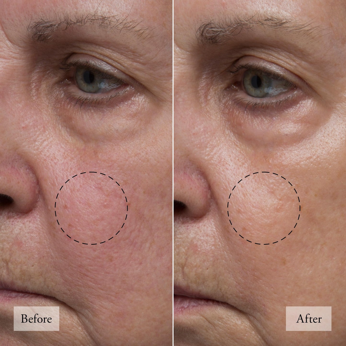 philosophy hope in a jar skincare essentials mini set