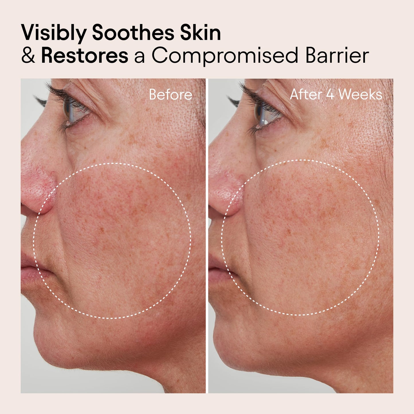 ALPYN Mini Barrier Repair Cream - Super Peptides & Ghostberry Moisturizer for Eczema I Deep Wrinkle Repair I Calm & Soothe Against Redness & Irritation - 0.5 oz / 15 ml