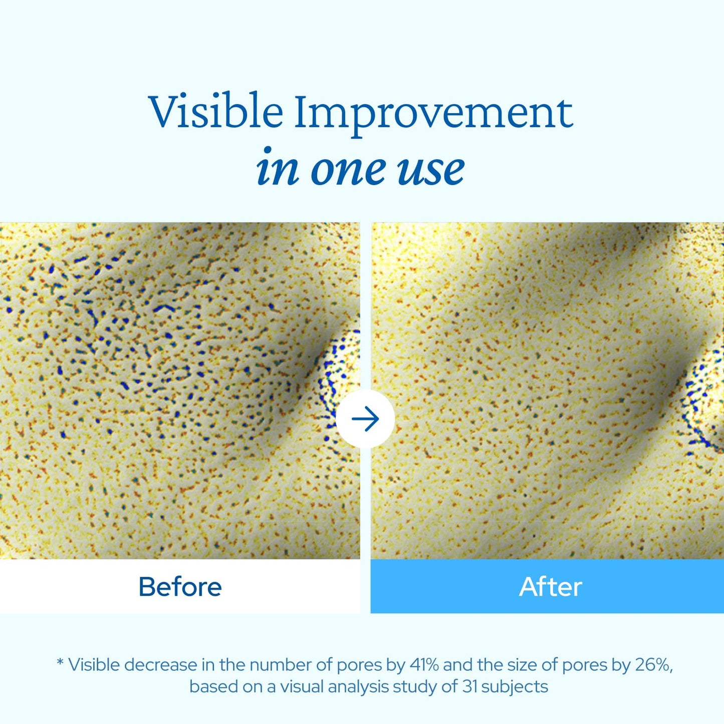 belif Aqua Bomb Cooling Relief Cream with Panthenol & Niacinamide – Daily Soothing & Hydrating Moisturizer, Depuff with Caffeine, Non-comedogenic, Lightweight Cream, Korean Skincare, 1.69 fl oz (50ml)