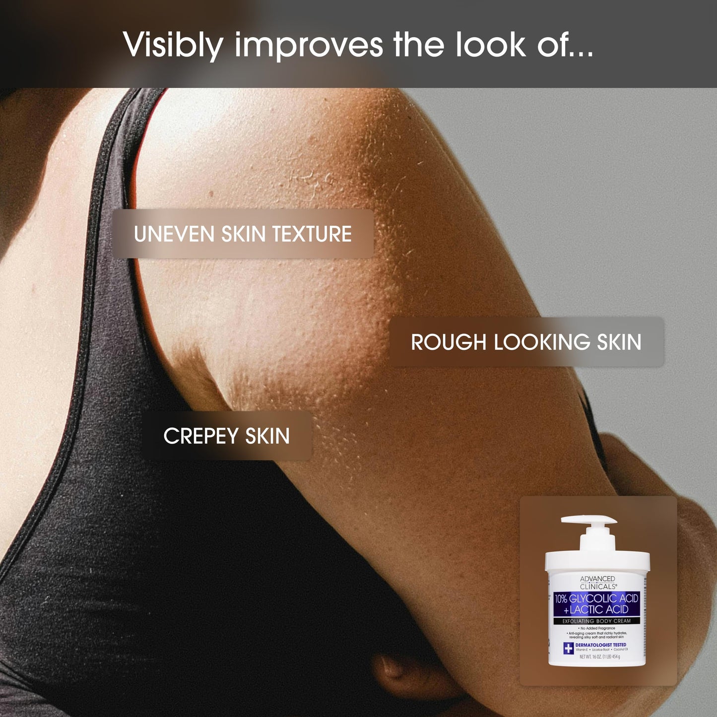 Advanced Clinicals 10% Glycolic Acid + Lactic Acid Body Lotion Moisturizer + AHA Glycolic Acid Face Serum 2pc Exfoliating Skincare Set To Reduce Look Of Uneven Rough Skin Texture, Fragrance Free, 2pc