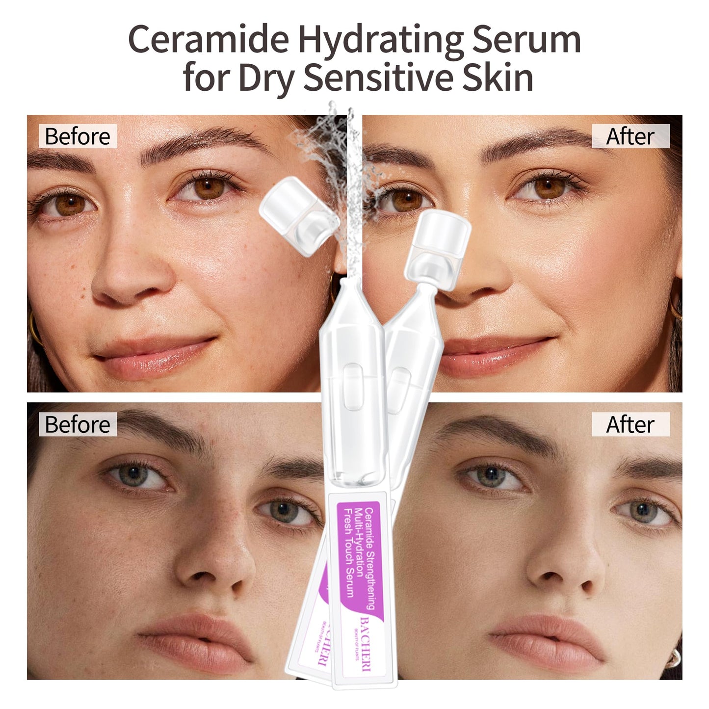 Ceramide Serum for Dry Sensitive Skin – Triple Ceramide Complex with Hyaluronic Acid, Hydrates & Repairs Skin Barrier, Soothes Redness & Irritation, 1.8ml x 30 Ampoules