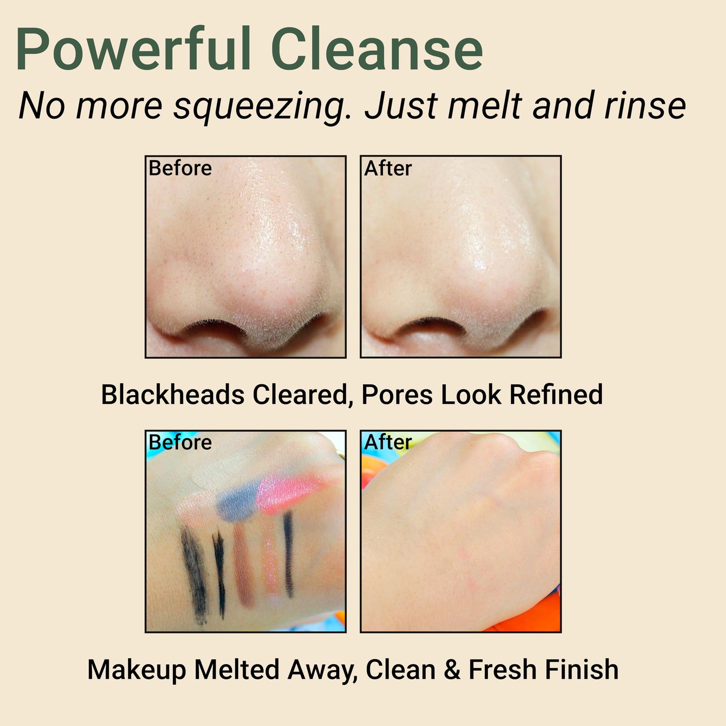 CELDYQUE Pore Purifying Cleansing Oil – Korean Face Wash with Centella, Tea Tree, Green Tea & LHA – Gentle Makeup Remover for Sensitive, Acne-Prone Skin, Deep Pore Cleanser, 6.76 fl oz