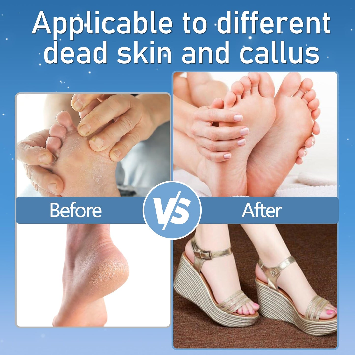 Jamestry Callus Remover for Feet, Electric Foot Callus Remover Waterproof with 3 Rollers 2 Speed Battery Display,17 in1 Rechargeable Foot File Pedicure Kits for Dead Hard Cracked Dry Skin