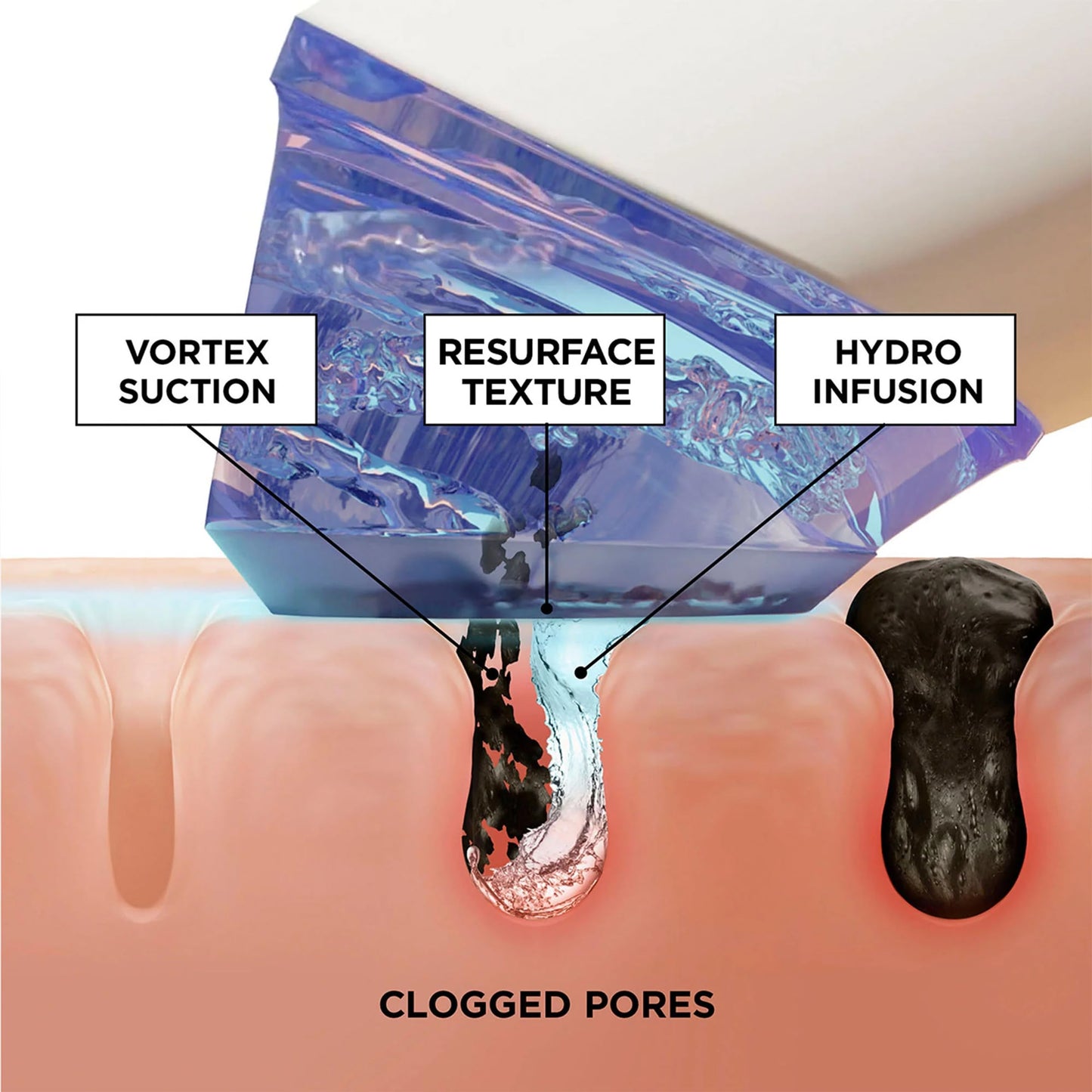 BeautyBio GLOfacial Hydro-Infusion Deep Pore Cleansing + Blue LED Clarifying Tool & Concentrates