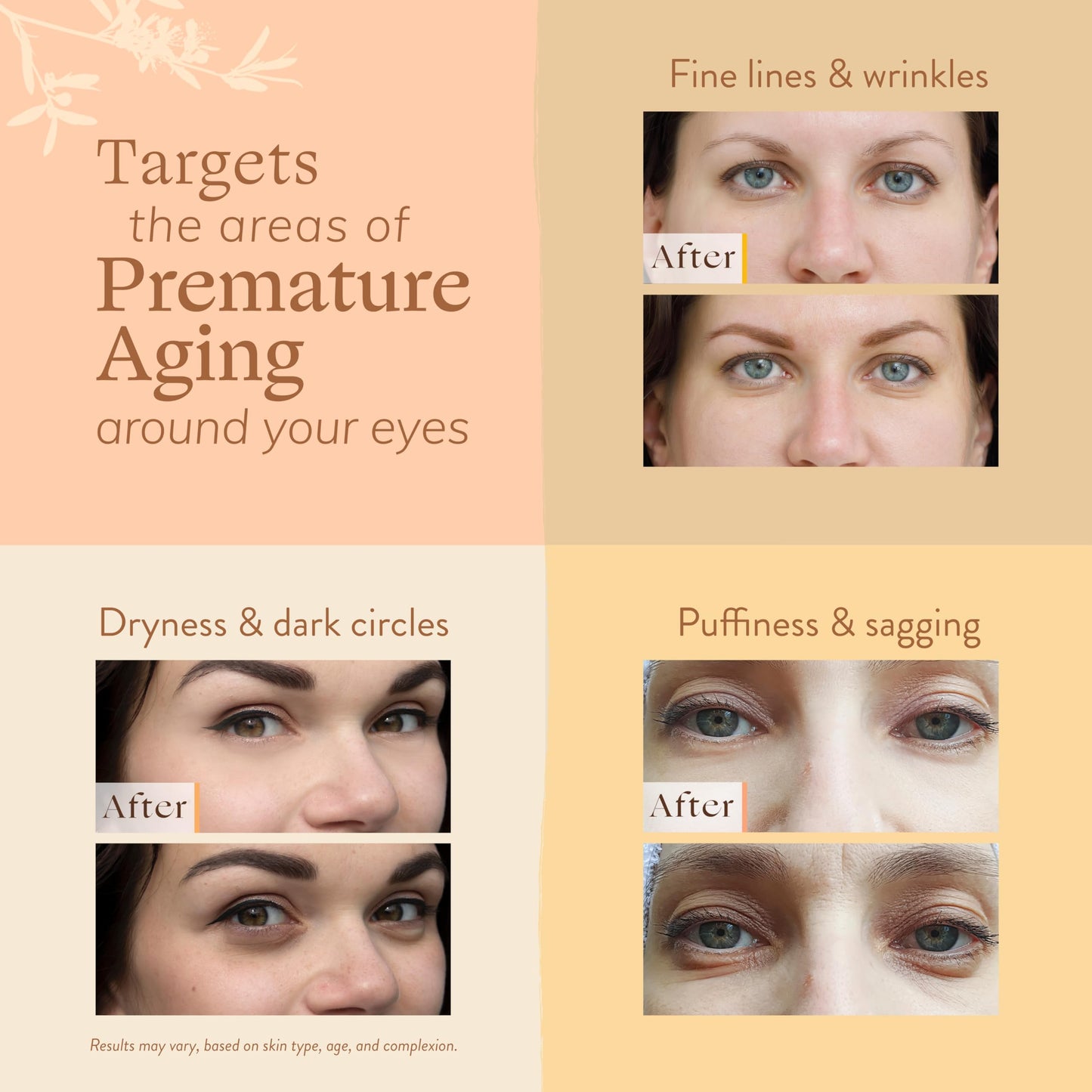 LILY SADO MILK+MANUKA™ Eye Repair Cream - Anti-Aging Natural Gentle Formula w/Coconut Milk, Manuka Honey, Sodium Hyaluronate & VITS C, B5 & E - Prevents Puffiness, Under-eye Wrinkles & Eye Bags - 1oz