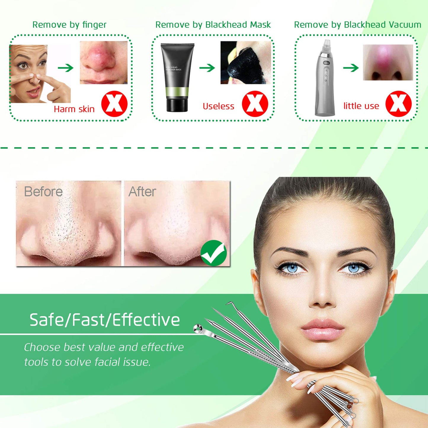 5PCS Blackhead Remover Comedone Extractor, Curved Blackhead Tweezers Kit, Professional Stainless Pimple Acne Blemish Removal Tools Kit for Manual