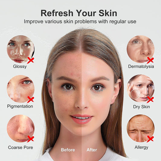 Newbealer Facial Steamer, Mini Aroma Face Steamer, Nano Ionic Hot Mist Facial Humidifier Atomizer, Home Sauna Spa Sprayer Moisturizing Cleansing Pores, 9 Pieces Acne Remover Kit (Pink-Gold, 160ml)