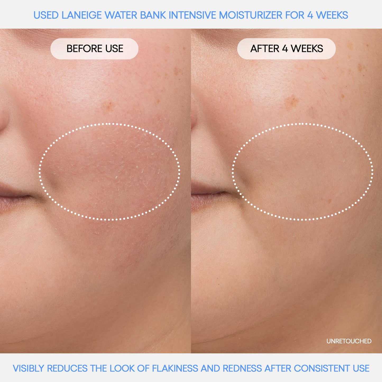 LANEIGE Water Bank Blue Hyaluronic Intensive Moisturizer Mini: Hydrating Face Cream for Very Dry Skin with Squalane & Peptide for Skin Barrier Support, Dermatologist-Tested