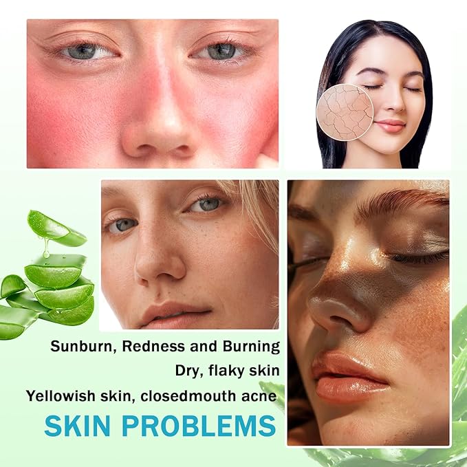 8PCS Organic Aloe Vera Gel for Face and Body,Moisturizing After Sun Lotion,Hydrating Travel Size Moisturizer,No Sticky Pure Aloe Gel for Hair,Skin,After Wax Care and After Sun Care