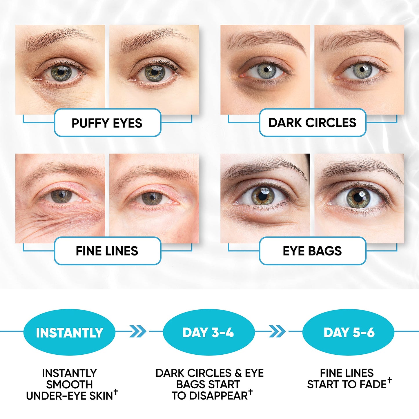 Under Eye Patches for Puffy Eyes, Dark Circles, Dull Skin - Natural Moisturizing Support - Help with Wrinkles and Fine Lines - Under Eye Mask with Hyaluronic Acid, Collagen, Caffeine - 30 Pairs