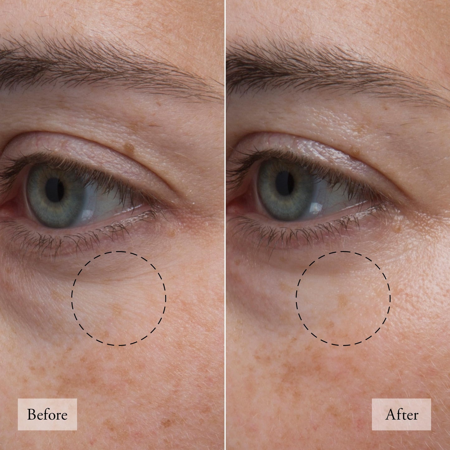 philosophy hope in a jar skincare essentials mini set