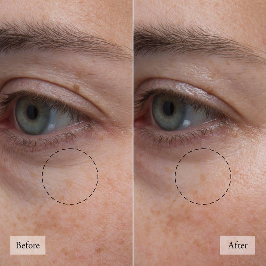 philosophy hope in a jar skincare essentials mini set