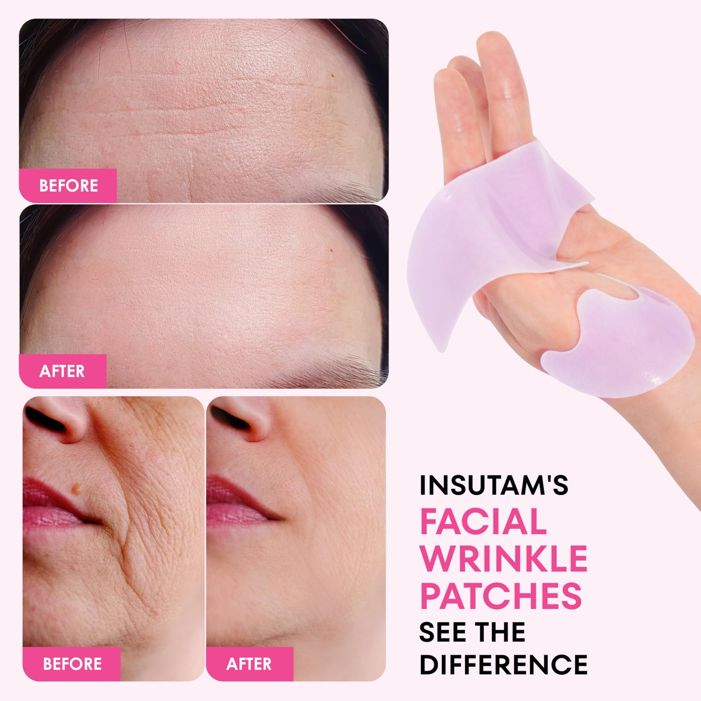 Insutam Forehead Wrinkle Patches for Anti-wrinkles: Overnight Face Wrinkles Patches to Lift Smile Lines for Women (PINK)