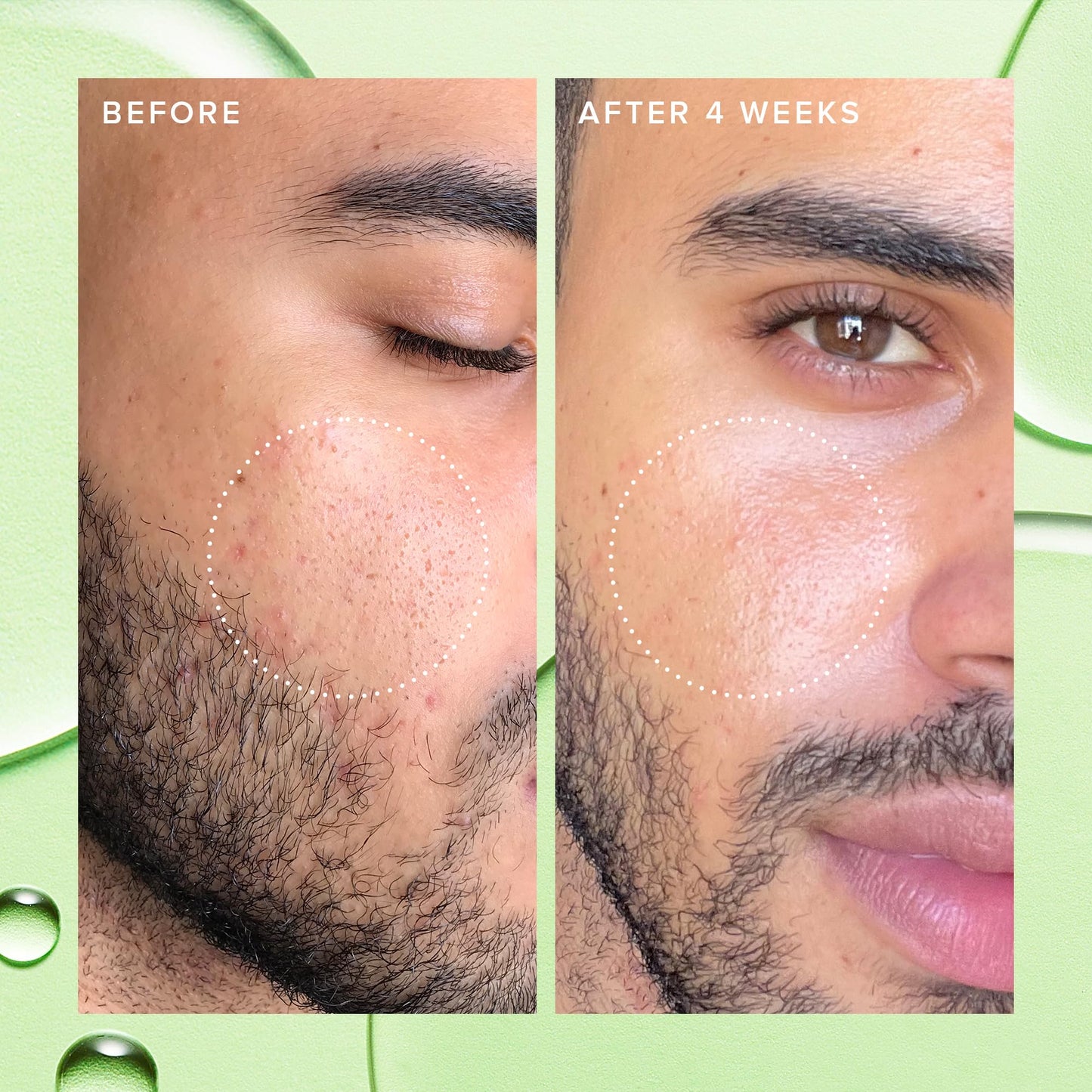 Farmacy 2% Salicylic Acid Toner for Face - Deep Sweep Gentle BHA Exfoliant for Oily Skin - Refines Texture with Papaya Enzymes & Moringa Water for a Healthy-Looking Complexion (10ml)