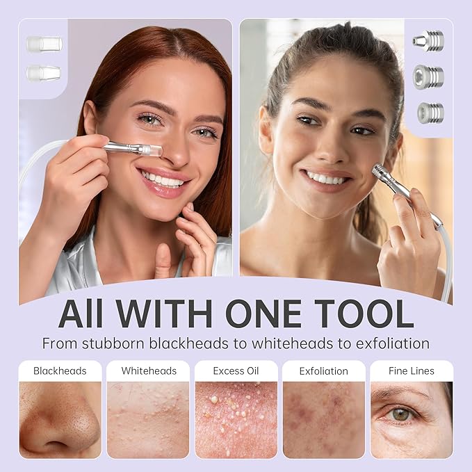 Blackhead Vacuum Removers, 2 in 1 Pro-Grade at-Home Spa Facial Vacuum Pore Cleaner for Blackheads, Whiteheads, Exfoliation, 20-80 Kpa Adjustable Suction for All Skin Types, White