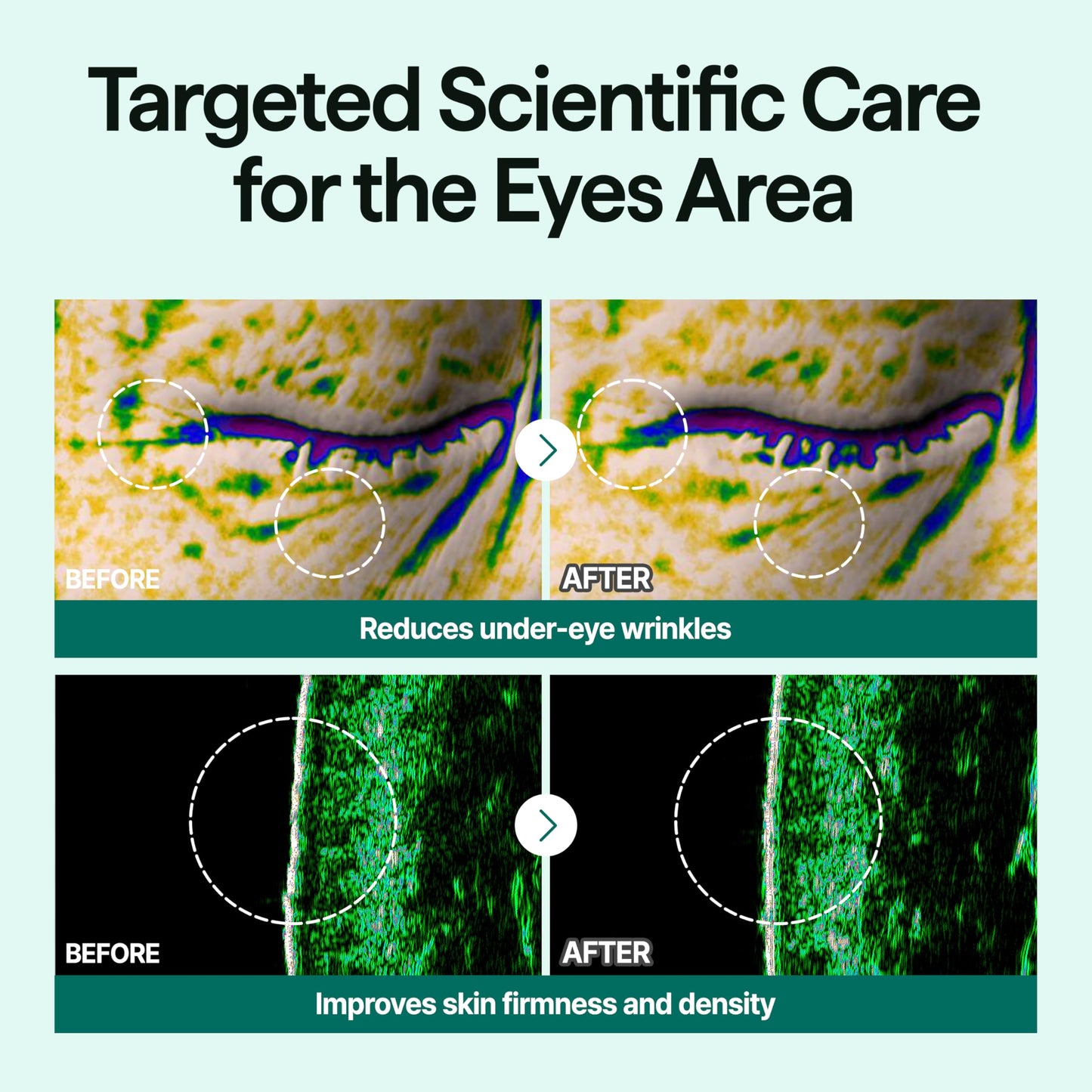 CELL IN SHOT Eyebanding PDRN Shot – Eye Area Firming and Wrinkle Care – Eye Cream for Elasticity and Hydration Around the Eyes, 0.52 fl.oz (15ml)