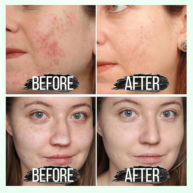 Blackhead Remover for Face - Peel Off Black Mask, Charcoal Mask, Nose Blackhead Pore Remover Deep Cleansing Blackhead Pores Acne