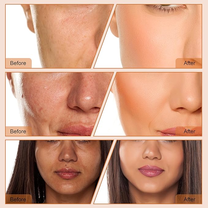 4 In 1 Diamond Dermabrasion Microdermabrasion Skin Scrubber Vacuum Facial peeling Sprayer Blackhead Acne Remover Skin Care Beauty Machine Elitzia ET33P4