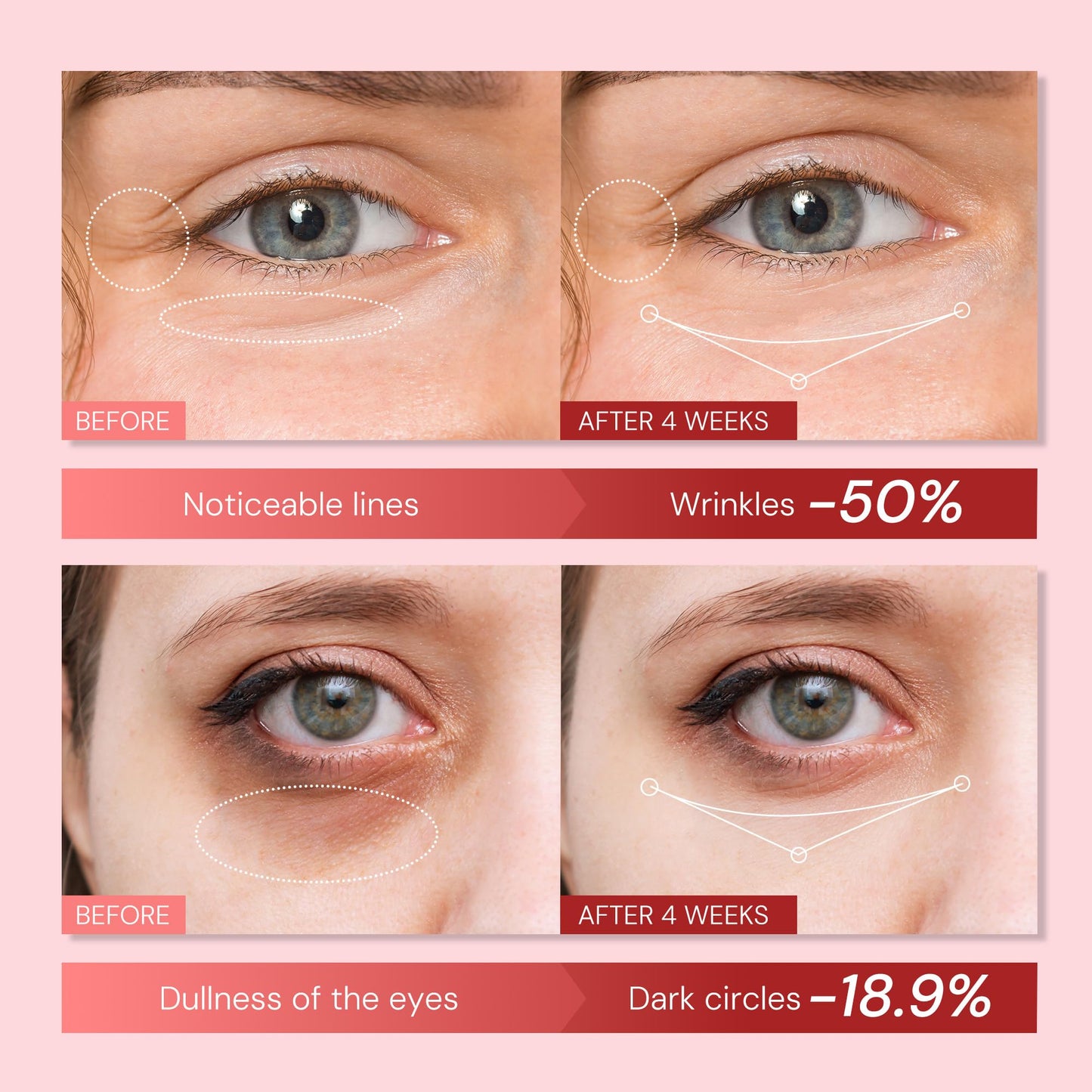 Retinol Anti Aging Eye Cream: Rapid Wrinkle Repair & Instant Under Eye Treatment - Reduce Dark Circles, Eye Bags, Puffiness for Women, Day & Night, 0.85 fl.oz