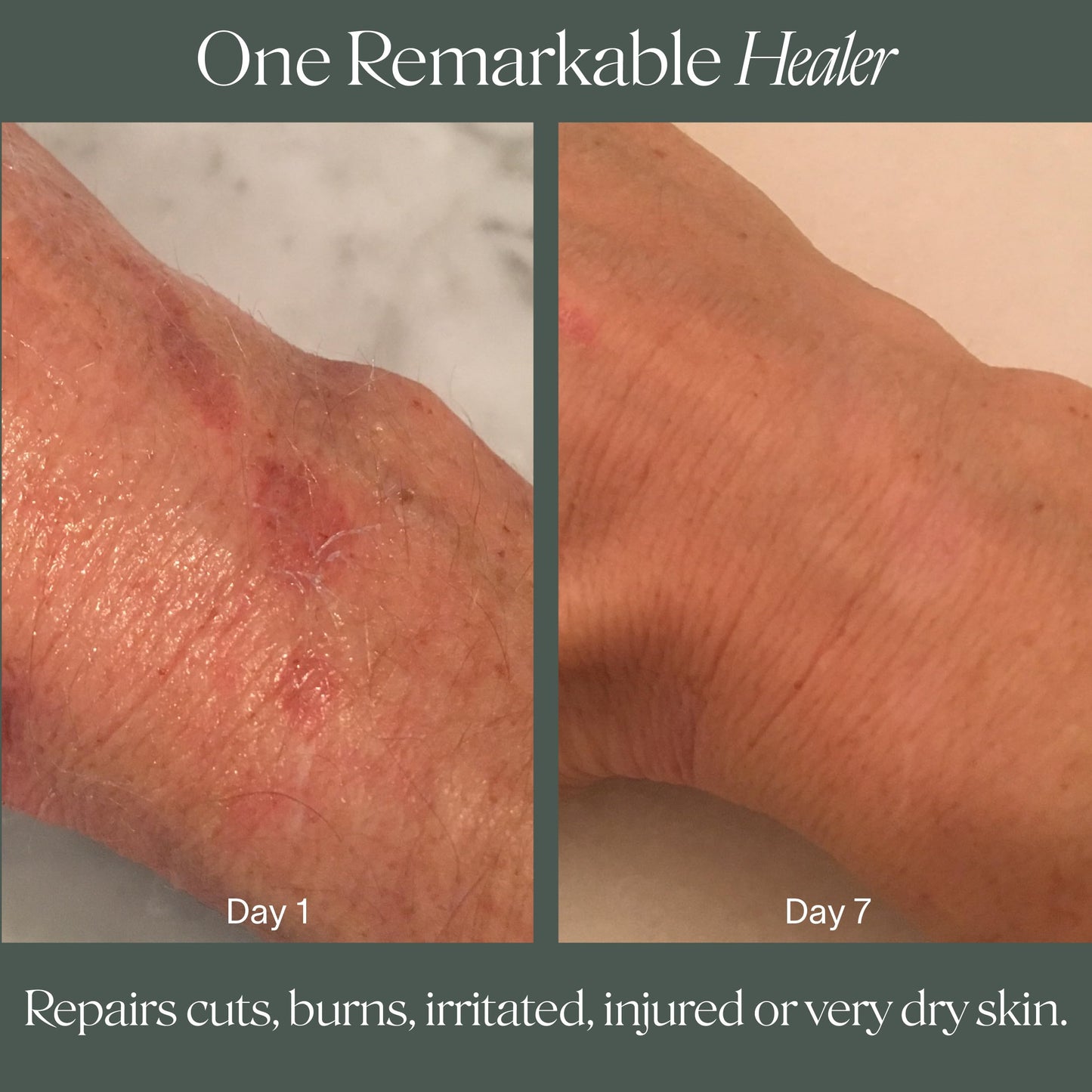 Doctor Rogers Restore Healing Balm. Multi-Purpose Healing Ointment & Moisturizing Eczema Relief Gel. Protects & Soothes Injured, Sensitive & Dry Skin 0.5 Ounce Tube (14 gram)