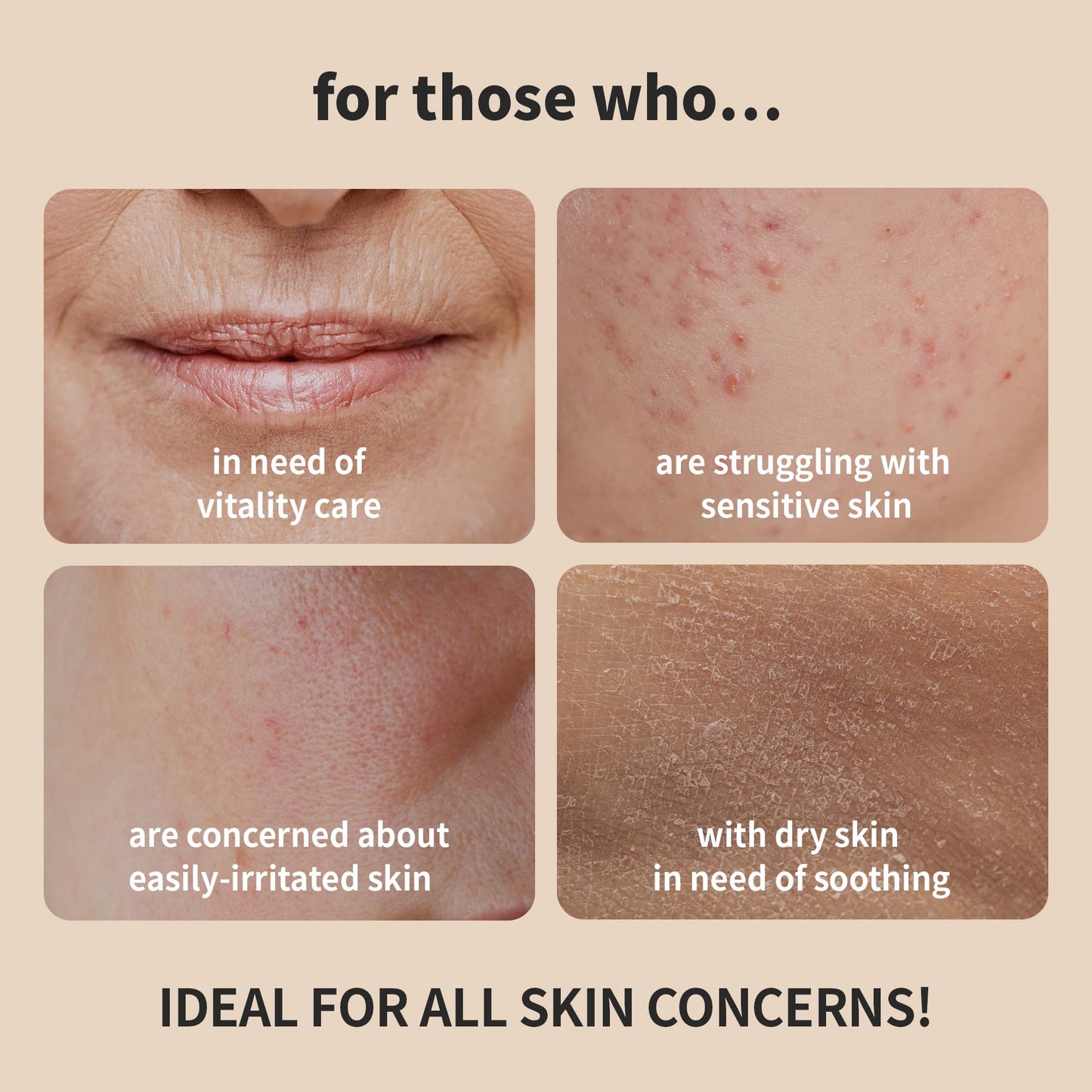 BENTON Snail Bee High Content Skin (Toner) - Snail Mucin Toner, Snail Mucin Essence Toner, Bee Venom Korean Toner, Korean Skin Care Snail Toner, Face Skin Care Snail Essence, Snail Mucin Moisturizer