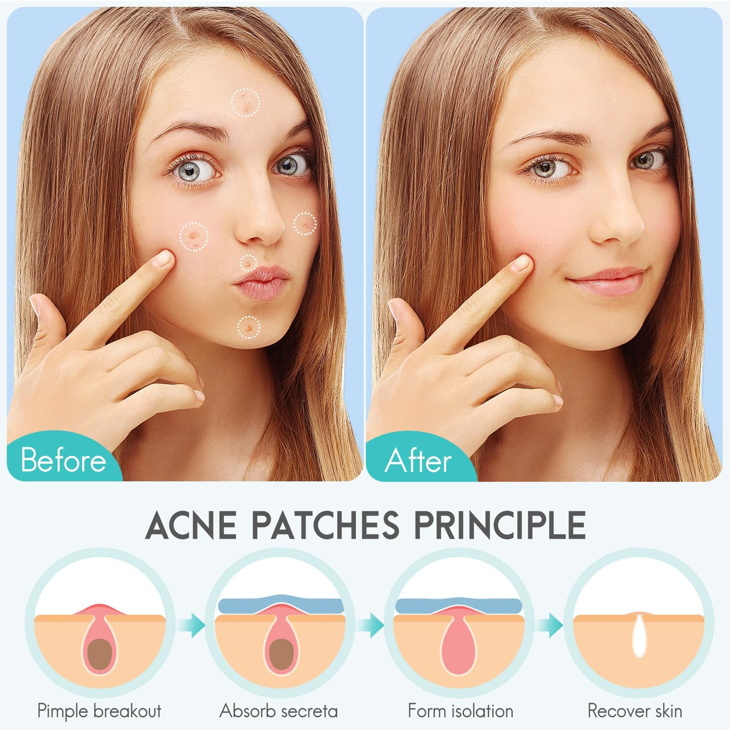 Acne Pimple and blackheads Remover Hydrocolloid patches, 350pcs Holiday colour Star and UltraThin Clear Stickers for Zits, Pimples, Acne,with Salicylic Acid, Tea Tree Oil, Centella acne stick set