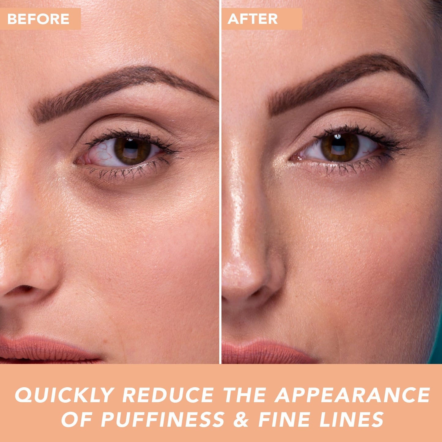 Hyaluronic Acid Eye Cream - USA Made with Natural & Organic Ingredients, Cooling Under Eye Gel & Brightener, Dark Circles Treatment with Hyaluronic Acid & Glycerin, Reduces Puffiness & Bags Under Eyes