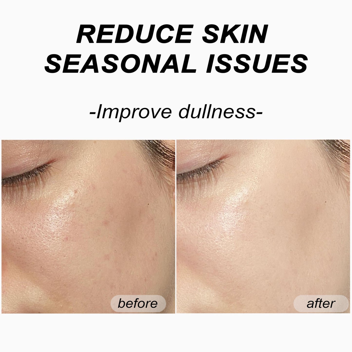 Bukamkom（8pcs Collagen Face Mask, Hydrogel Overnight Face Mask for Hydration & Soothing, Hydrogel Collagen Facial Mask, Face Masks Facial Masks Skincare