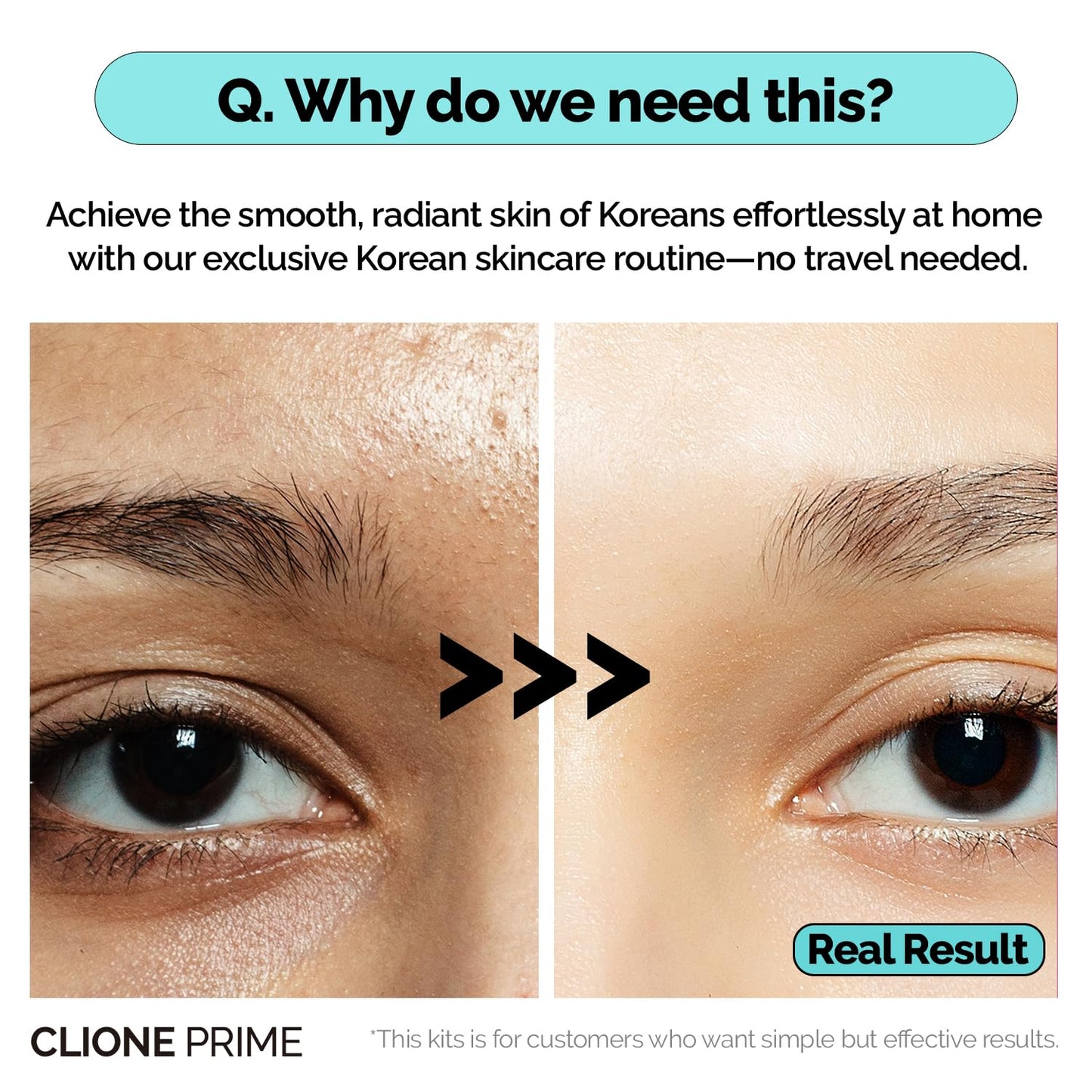 CLIONE PRIME KBeauty Skin Clinic at Home - 4 Step Night Care Kit - Anti-Aging Lifting & Firming Treatment for Wrinkles, Elasticity & Hydration - Korean Skincare Essence, Mask, Booster & Ampoule Set