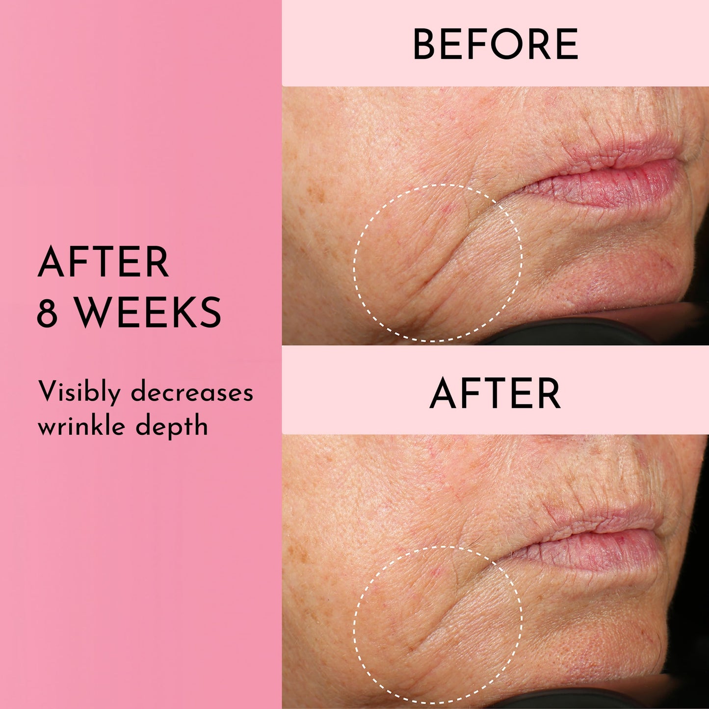 Lawless Mini Forget the Filler Skin-Plumping Line-Smoothing Perfecting Cream - Premium Non-Acne Moisturizer Designed to Prime, Plump, Smooth, and Tighten Skin for a Youthful, Hydrating Look - 0.5 oz