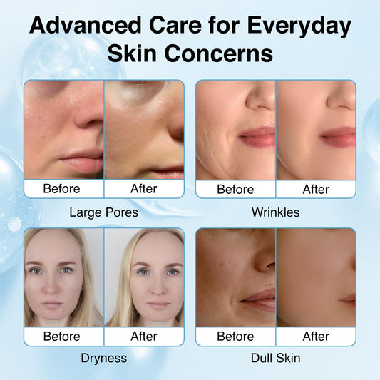 Collagen Face Mask - 6 Pack, Hydrating & Firming Sheet Mask for All Skin Types, Anti-Wrinkle, K-Beauty & Moisturizing Overnight Skincare