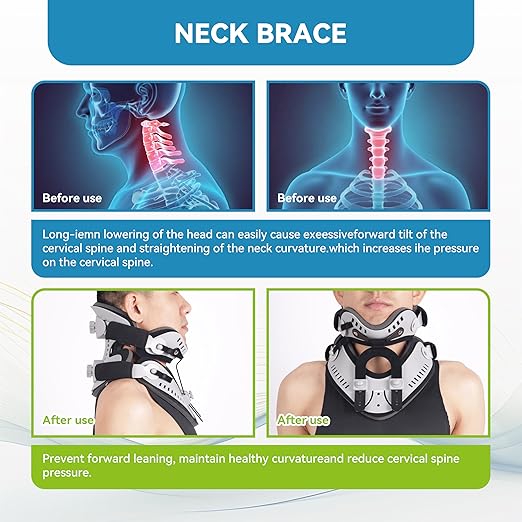 Adjustable Cervical Neck Traction Device for Home Use, Portable Over Door Neck Stretcher with Posture Corrector, Pain Relief & Decompression Support