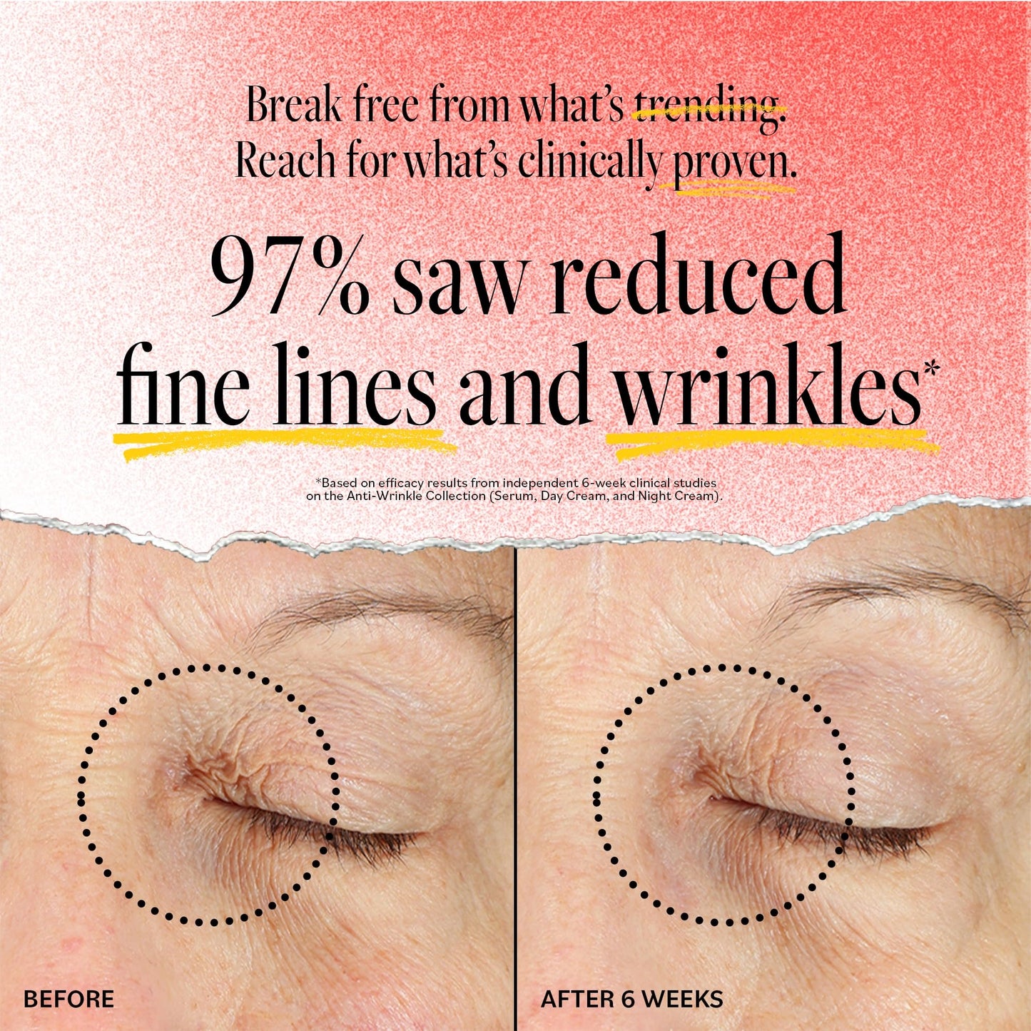 DERMA E Face Serum, Anti Aging Regenerative Retinol Serum for Face, 1 Fl Oz, Vitamin A, Bakuchiol, Glycolic Acid, Green Tea Extract, Helps Reduce Appearance of Fine Lines and Wrinkles