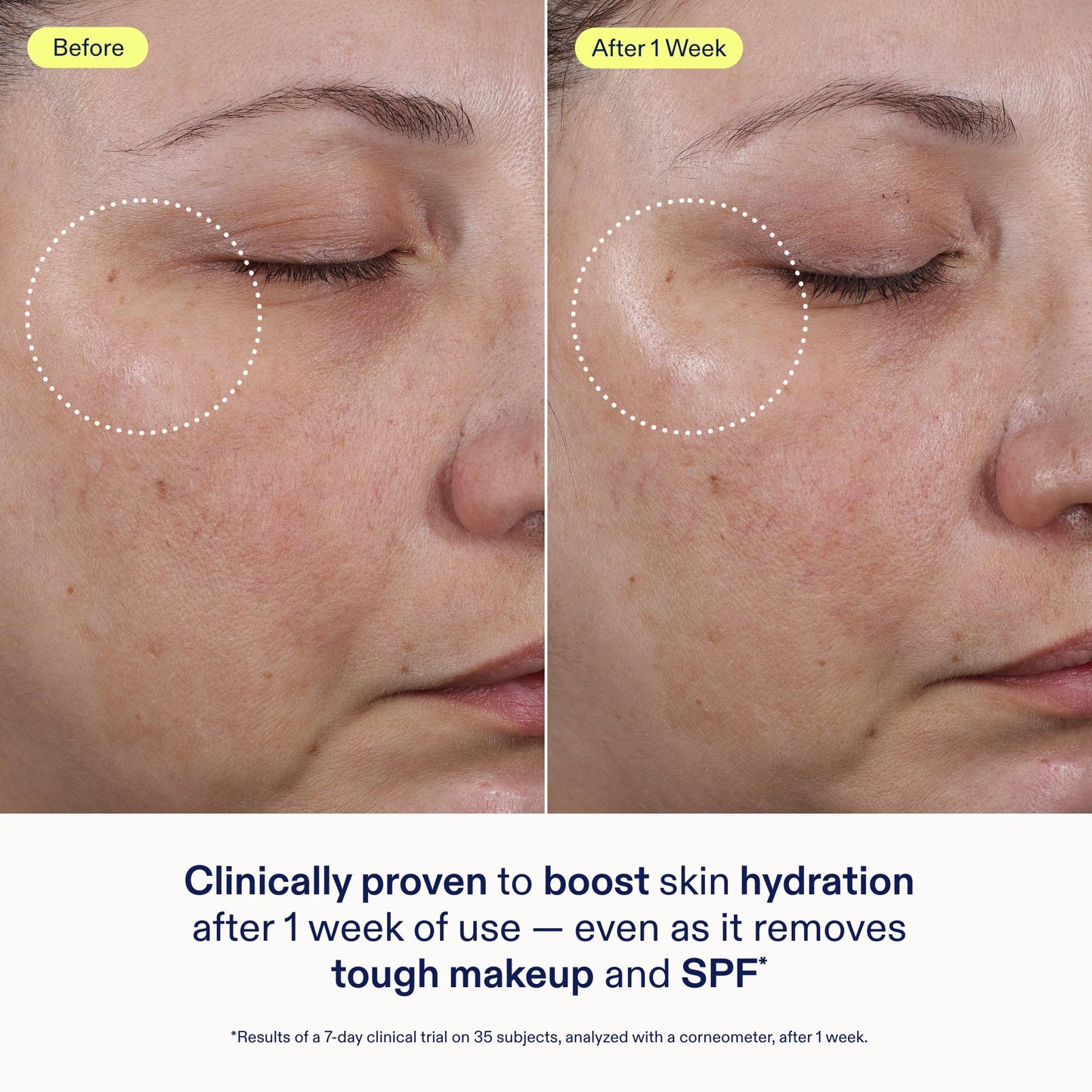 Skinfix Ceramide + Ectoin Gentle Gel Cleanser Mini - 1.5 oz - Removes Makeup & SPF - Cleanses & Hydrates Skin - Vegan, Cruelty Free